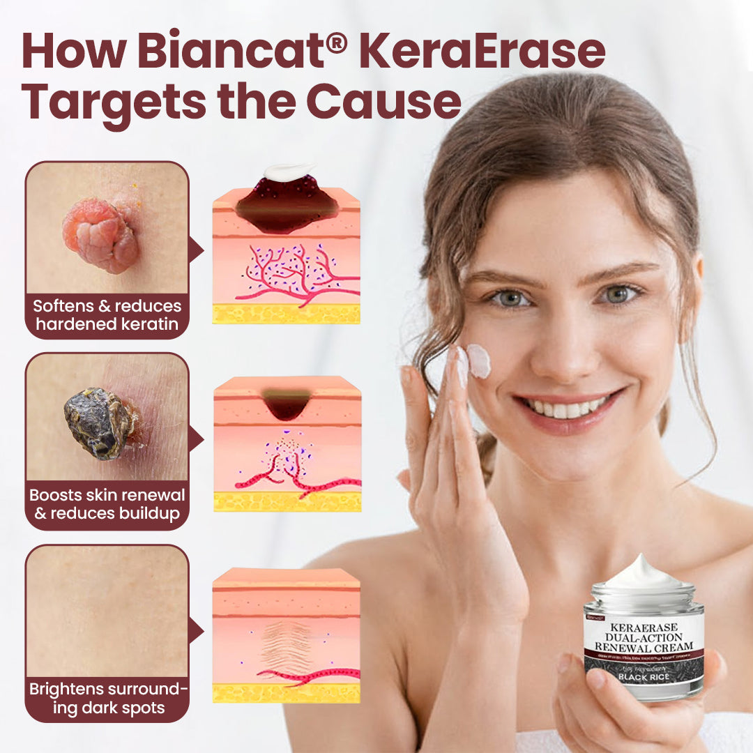 Biancat®KeraErase Dual-Action Renewal Cream.