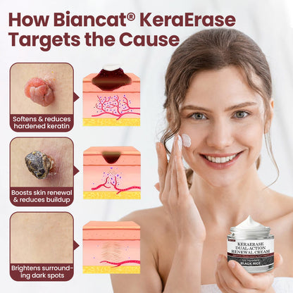 Biancat®KeraErase Dual-Action Renewal Cream.